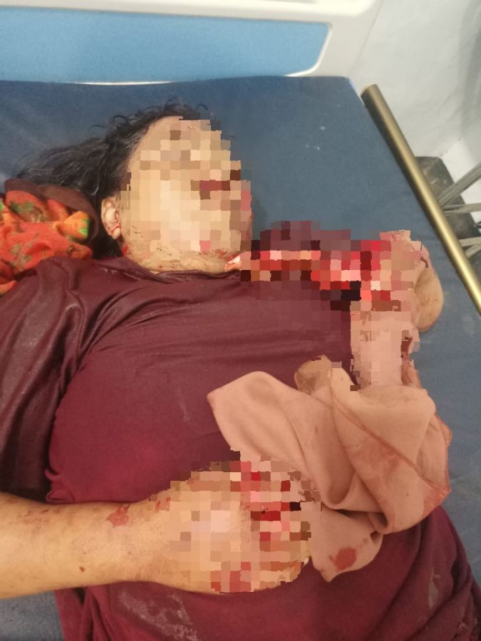 Tragedi Berdarah di Desa Adu Kabupaten Dompu: Suami Gorok Istri, Akibat Tak Tahan Di'omelin Istri